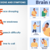 Brain Stroke Types Causes Risk Factors symptoms Prevention
