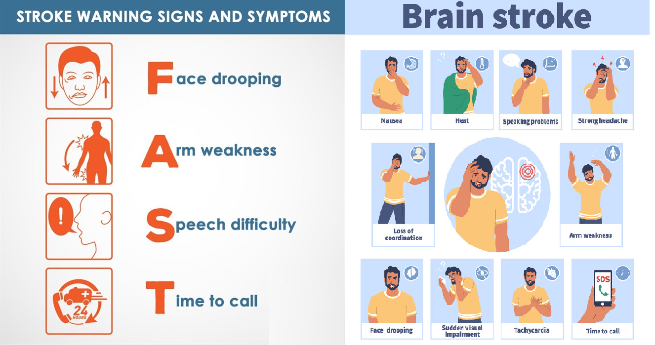 Brain Stroke Types Causes Risk Factors symptoms Prevention