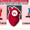 Cardiac Arrest vs Heart Attack