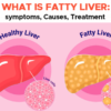 What to Know About  Fatty Liver Grade 1 and Fatty Liver Grade 2 Causes, Symptoms, and Treatment